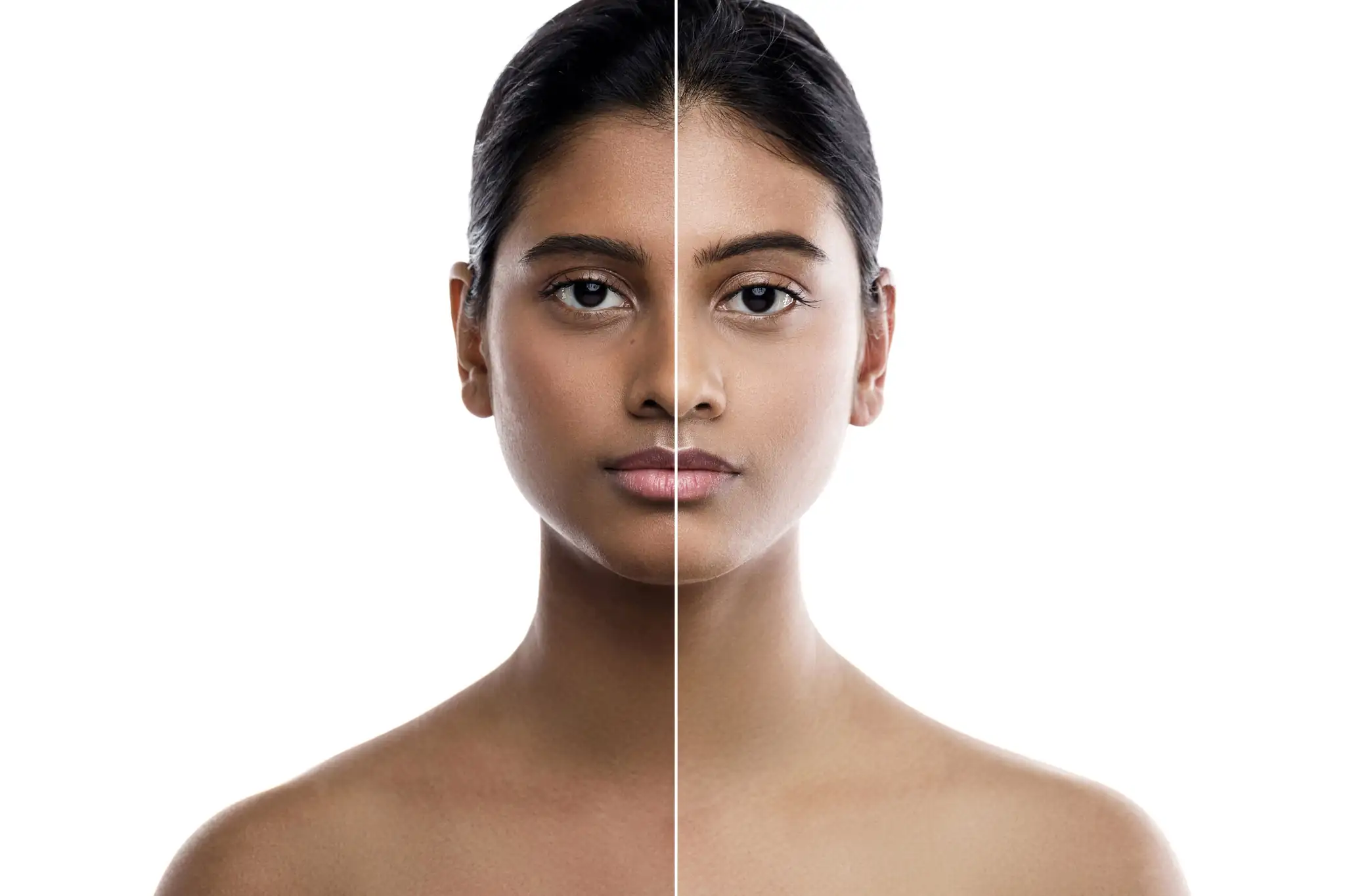 Skin Lightening